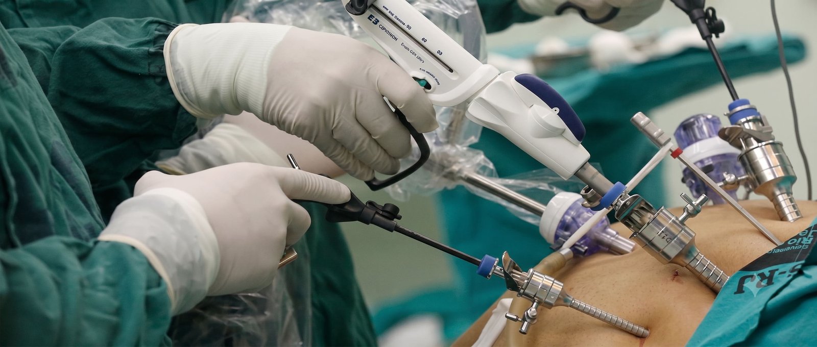 Laparoscopic and General Surgery Under One Roof